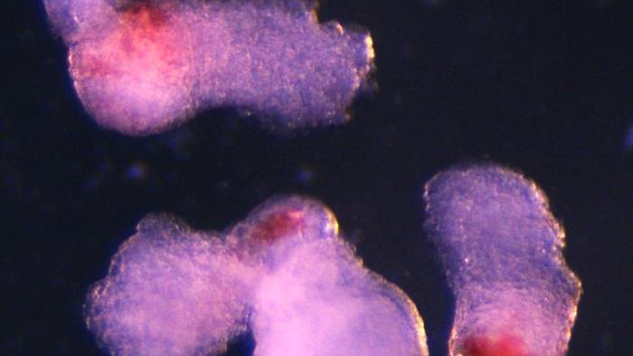 Hematoides
