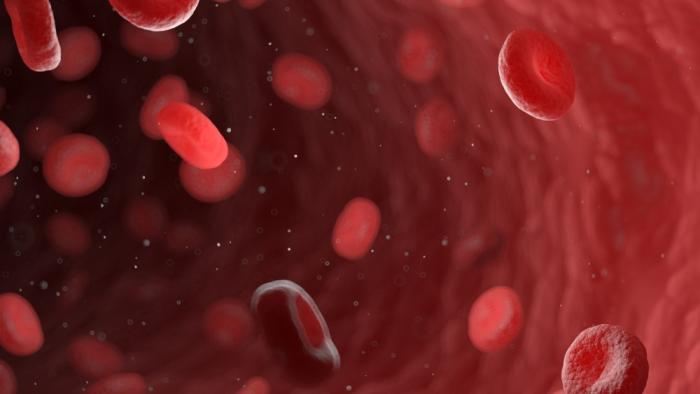 Un estudio afirma que los pacientes de infarto de miocardio presentan más niveles de micro y nanoplásticos en sangre Sangre