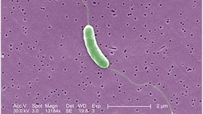 vibrio